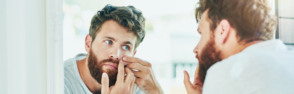acne treatment tampa fl