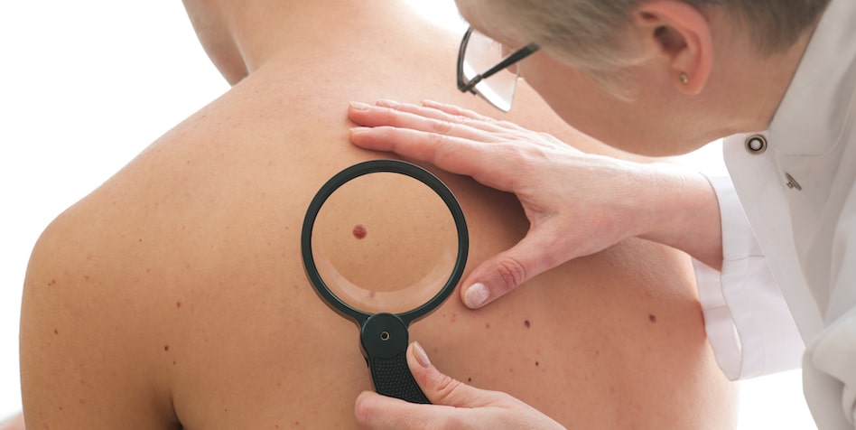 clinical dermatology for moles dade city fl