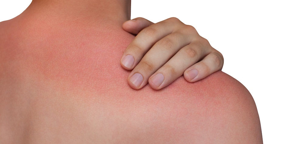 clinical dermatology for sun damage dade city fl