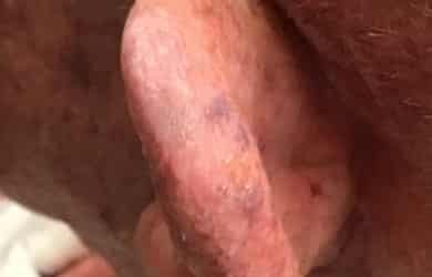 gentlecure treatment specialist tampa fl